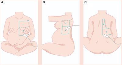 Lung Ultrasound Signs and Their Correlation With Clinical Symptoms in COVID-19 Pregnant Women: The “PINK-CO” Observational Study